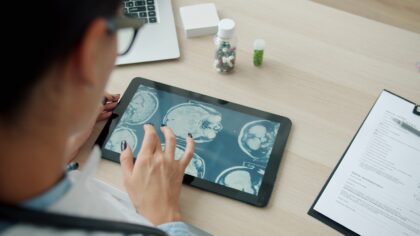 Smegenų ir kompiuterio sąsajos be fantastikos: kur jau taikoma ši technologija ir kokie jos ribojimai